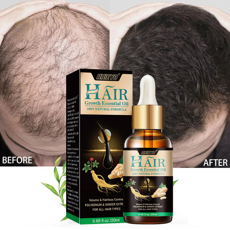 Epidermal Growth Factor - 2023 biotina olio per la crescita