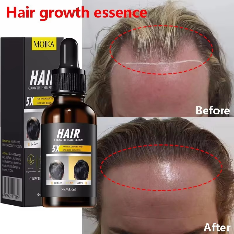 Epidermal Growth Factor - Siero per la crescita rapida dei