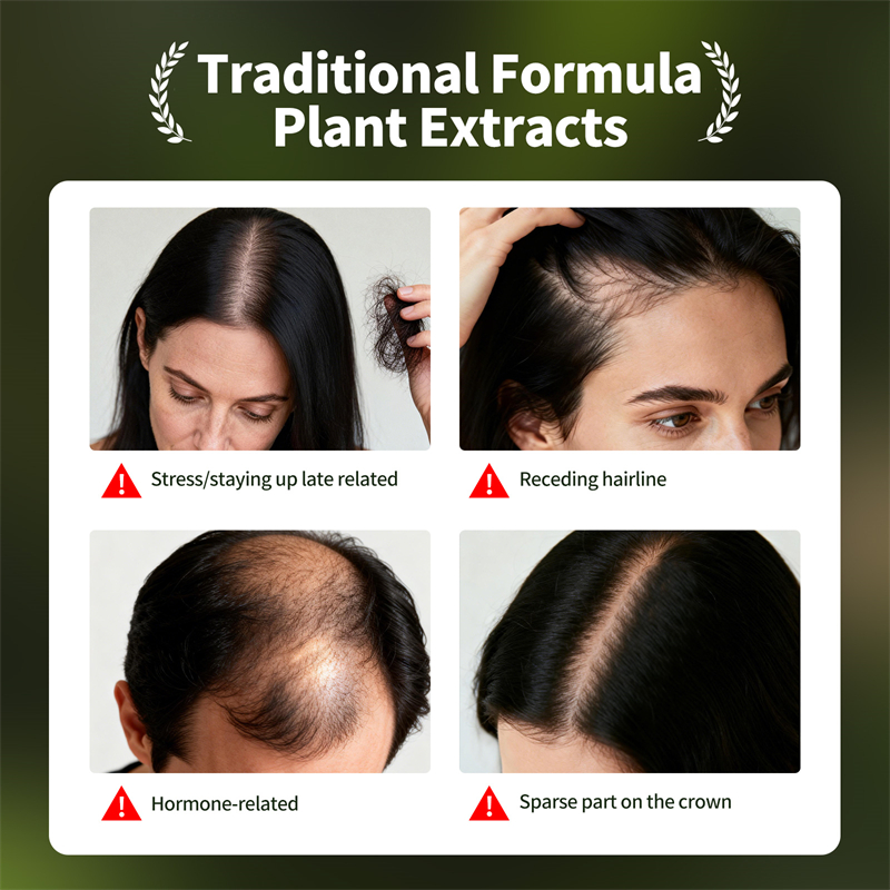 Set per la crescita dei capell - Epidermal Growth Factor recensione e prezzo