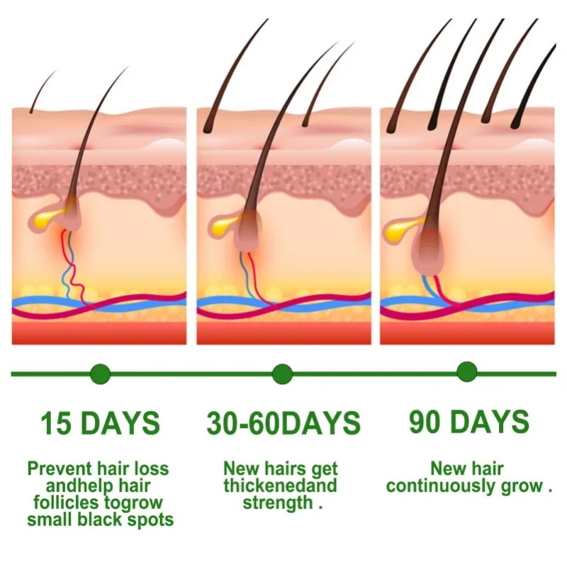 Siero per la crescita dei cape - Epidermal Growth Factor recensione e prezzo