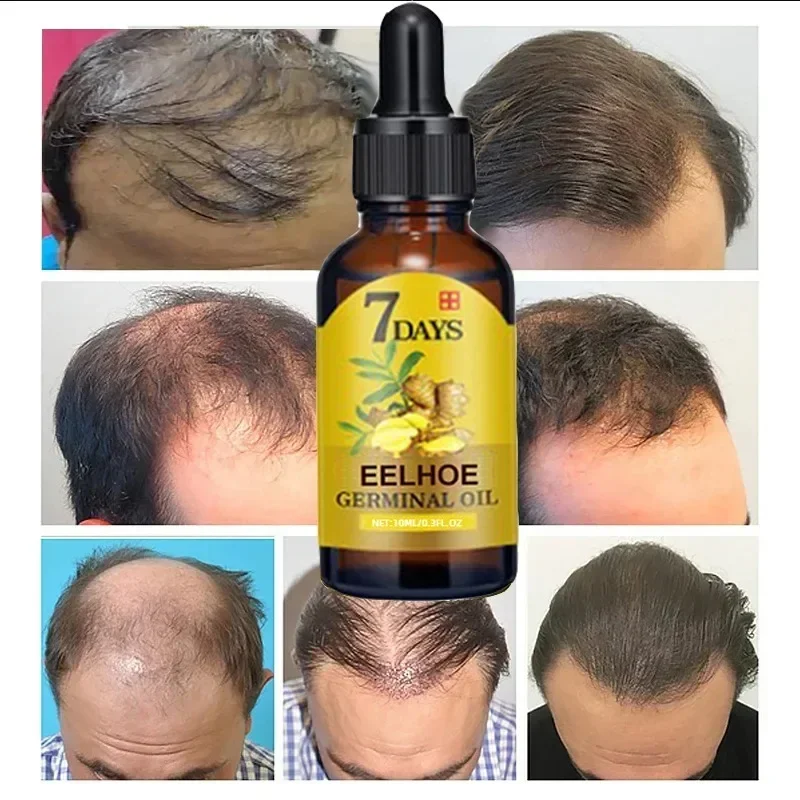 7 giorni olio per la crescita  - Epidermal Growth Factor recensione e prezzo