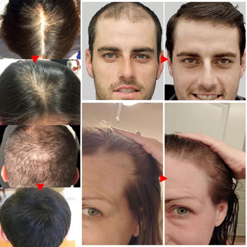 2023 biotina olio per la cresc - Epidermal Growth Factor recensione e prezzo