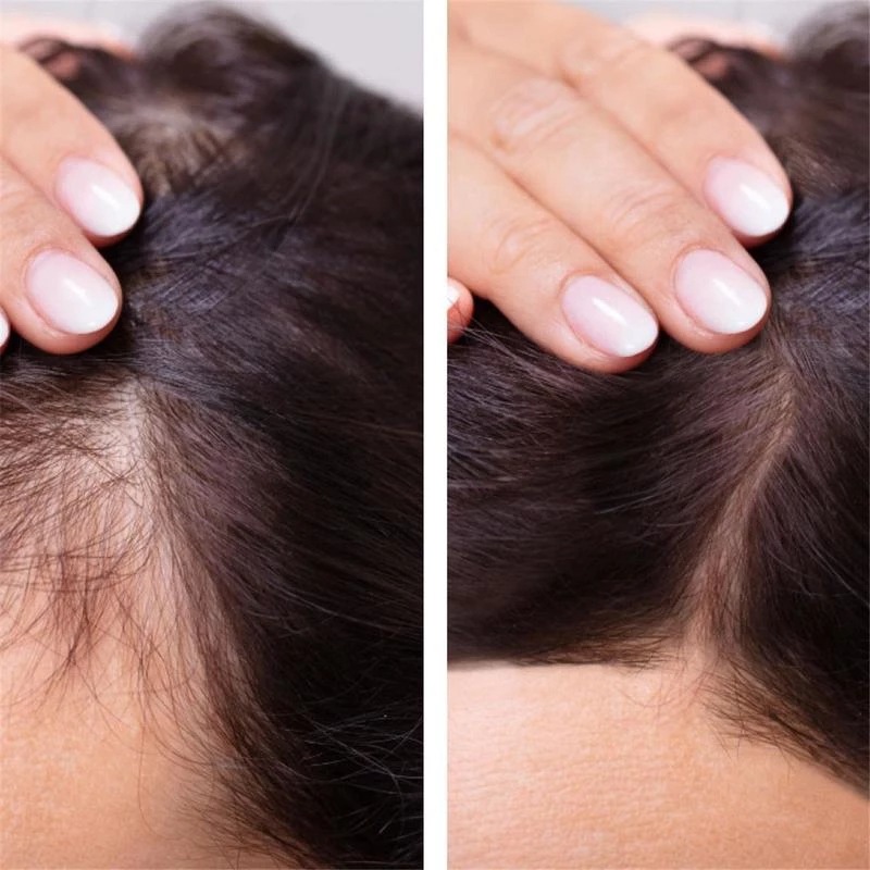 2023 biotina olio per la cresc - Epidermal Growth Factor recensione e prezzo