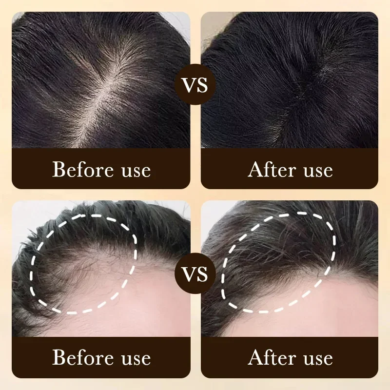 Olio per Crescita Rapida dei C - Epidermal Growth Factor recensione e prezzo