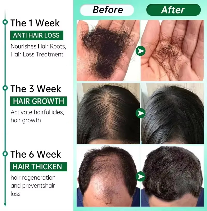 Siero per la crescita dei cape - Epidermal Growth Factor recensione e prezzo