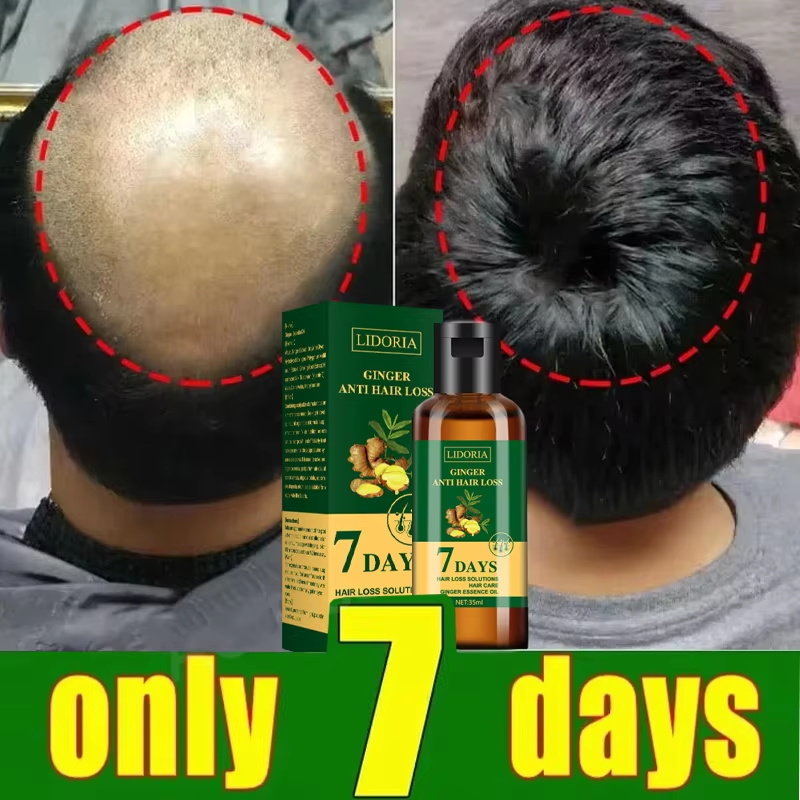 Siero per la crescita dei cape - Epidermal Growth Factor recensione e prezzo