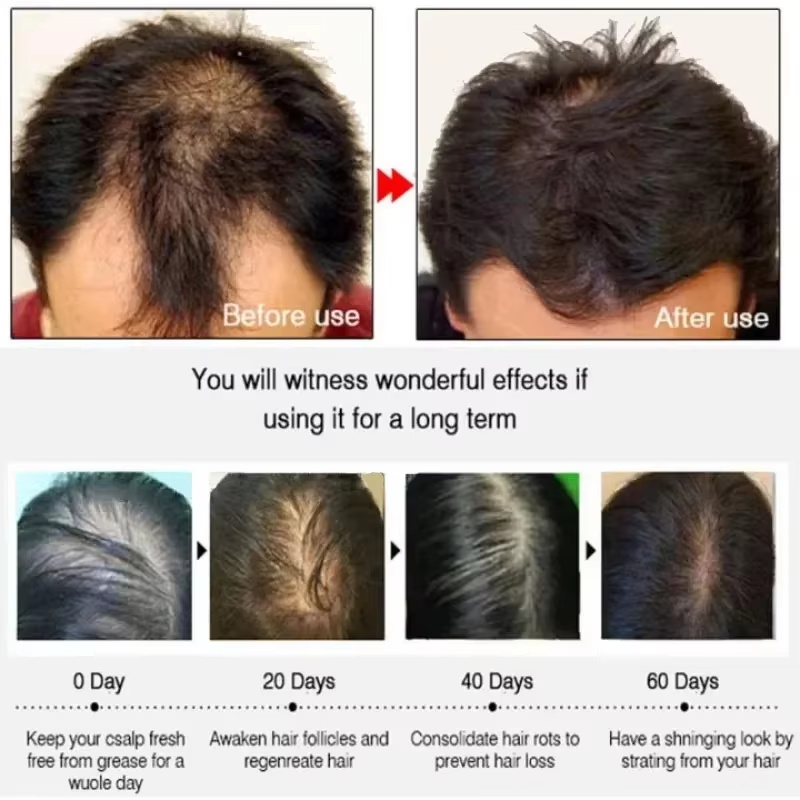Siero per la crescita dei cape - Epidermal Growth Factor recensione e prezzo