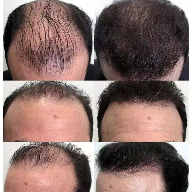 Siero per la crescita rapida d - Epidermal Growth Factor recensione e prezzo